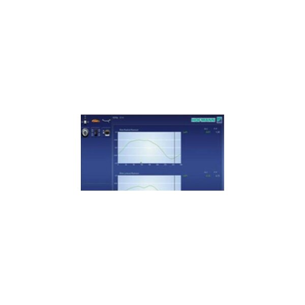 Das Bild zeigt eine blaue Radwuchtmaschine, auf der ein Autoreifen mit Felge montiert ist. Oben auf der Maschine befindet sich ein Monitor mit einem angezeigten Reifenbild. Die Maschine hat verschiedene Ablagefächer und Metallteile zum Fixieren des Rads. Vorne ist ein schwarz-gelber Streifen als Warnmarkierung zu sehen.